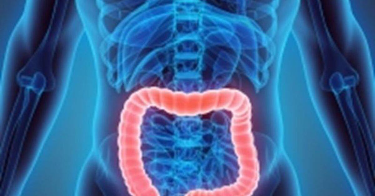 To Your Good Health Does ulcerative colitis preclude